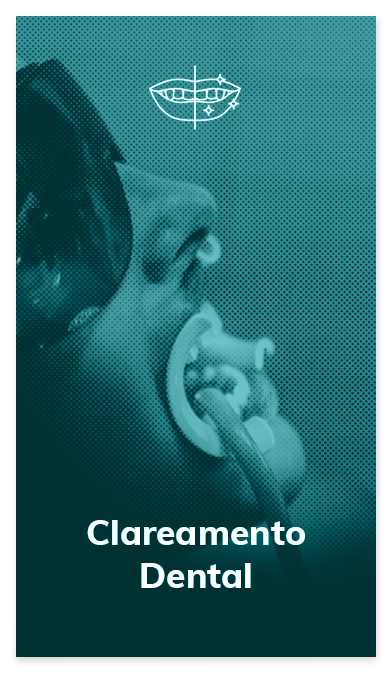 card-clareamento-oral-dente-1.png