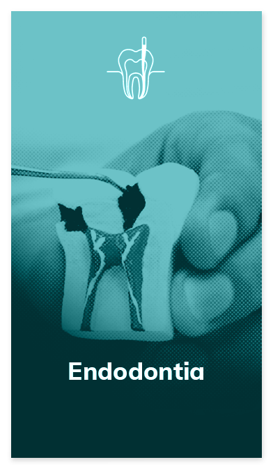 card-endodontia-oral-dente-1.png