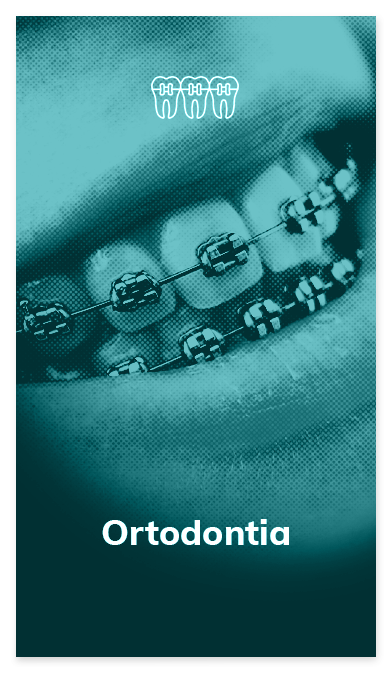 card-ortodontia-oral-dente.png