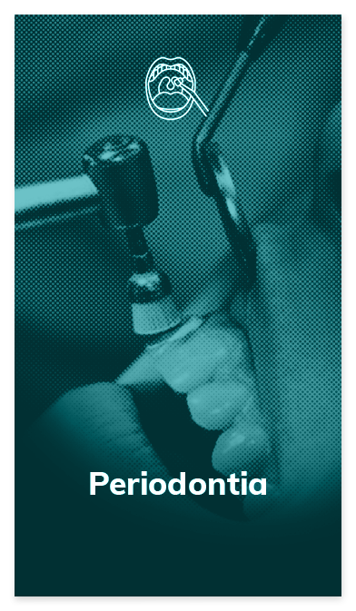 card-periodontia-oral-dente-1.png